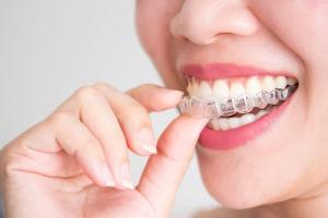 Địa chỉ niềng răng uy tín nhất tỉnh Bắc Ninh