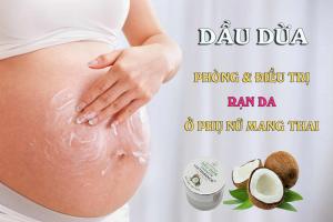 Cách trị rạn da sau sinh hiệu quả tại nhà