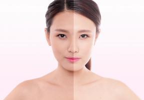 Kem dưỡng ẩm hữu cơ tốt nhất dành cho da