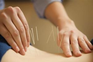 Bác sĩ châm cứu giỏi nhất Hà Nội