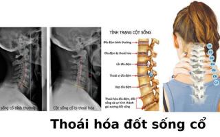 Bác sĩ khám chữa thoái hoá đốt sống cổ giỏi nhất tại TP. HCM