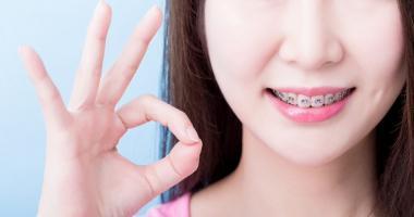Địa chỉ niềng răng uy tín nhất tỉnh Quảng Ngãi