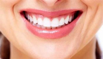 Địa chỉ tẩy trắng răng uy tín nhất tỉnh Bắc Ninh
