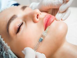 Địa chỉ tiêm filler - botox uy tín và chất lượng nhất Nha Trang