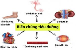 Lời khuyên hữu ích  nhất cho bệnh nhân tiểu đường
