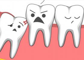 Nha khoa nhổ răng khôn tốt nhất tại Ba Đình, Hà Nội