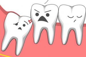 Nha khoa nhổ răng khôn uy tín nhất tại quận 10, TP. HCM