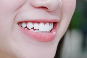 Phòng khám nha khoa uy tín nhất tại Trảng Bom, Đồng Nai