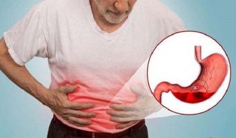 Sản phẩm hỗ trợ điều trị đau dạ dày