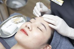 Spa trị mụn hiệu quả nhất ở Đồng Nai