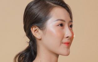 Thẩm mỹ viện nâng mũi trả góp uy tín nhất tại TP. Hồ Chí Minh