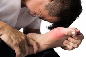Thực phẩm chức năng hỗ trợ điều trị bệnh Gout hiệu quả nhất hiện nay