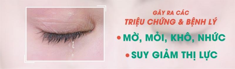 Bệnh về võng mạc làm mắt mờ, khô, mỏi