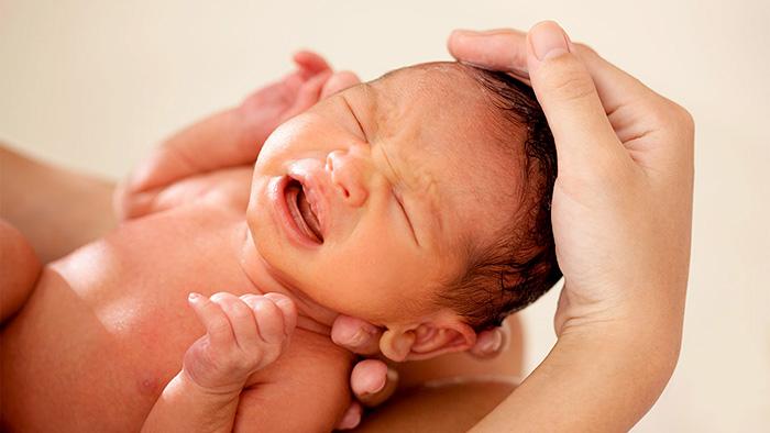 Bệnh vàng da sơ sinh là gì?