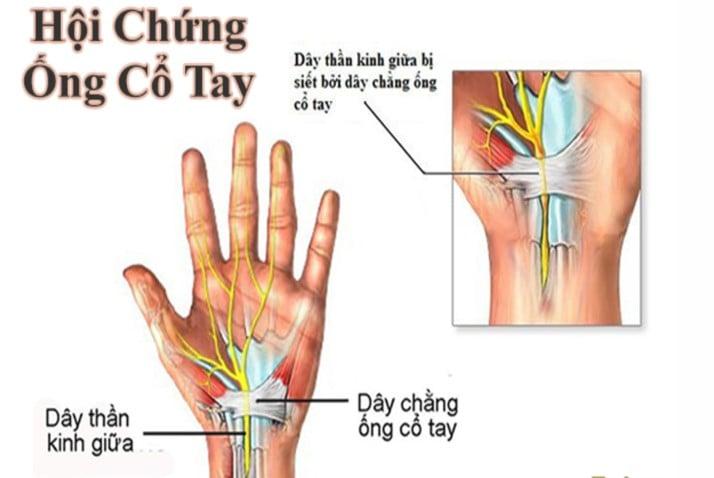 Bệnh viện Quân đội 108