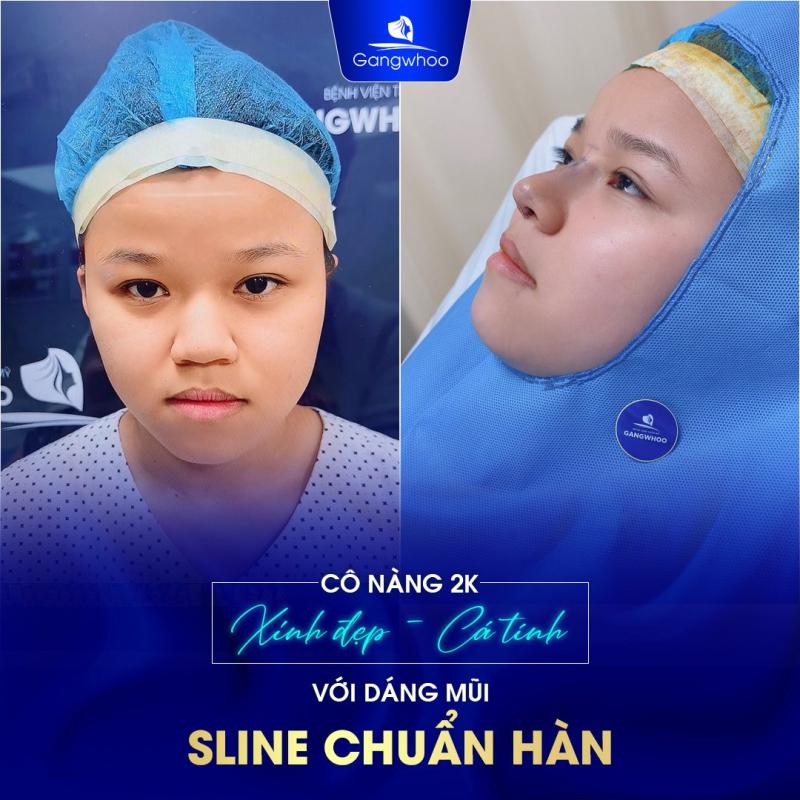 Bệnh viện thẩm mỹ Gangwhoo