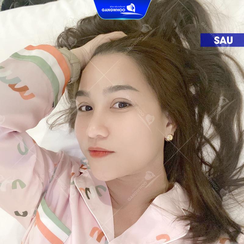 Bệnh viện thẩm mỹ Gangwhoo