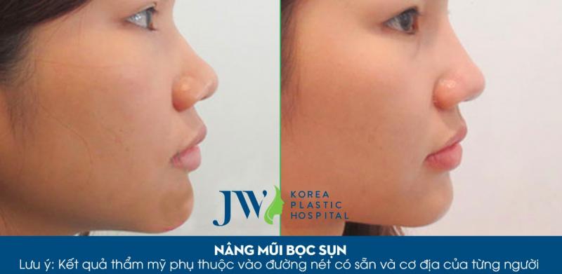 Bệnh viện thẩm mỹ JW