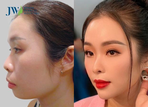 Bệnh viện thẩm mỹ JW Hàn Quốc