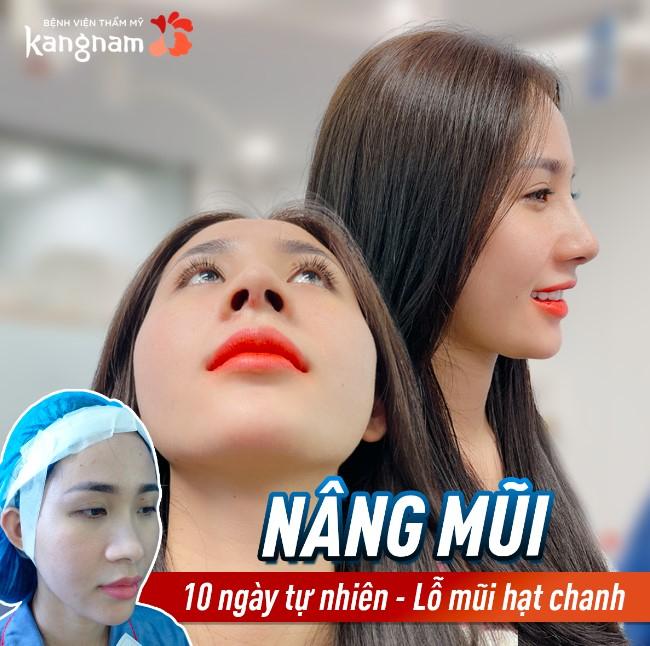 Bệnh viện thẩm mỹ Kangnam