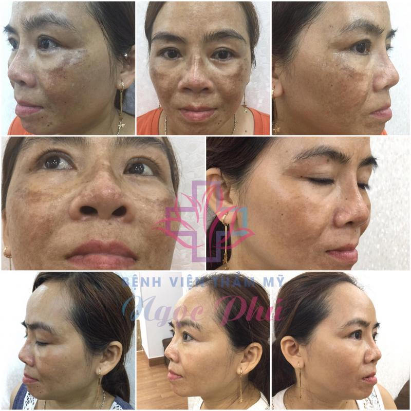 Bệnh Viện Thẩm Mỹ Ngọc Phú