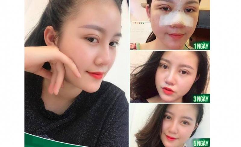 Bệnh viện thẩm mỹ Thu Cúc