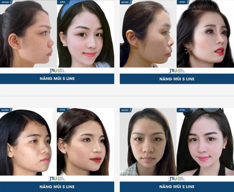 Bệnh viện thẩm mỹ Thu Cúc