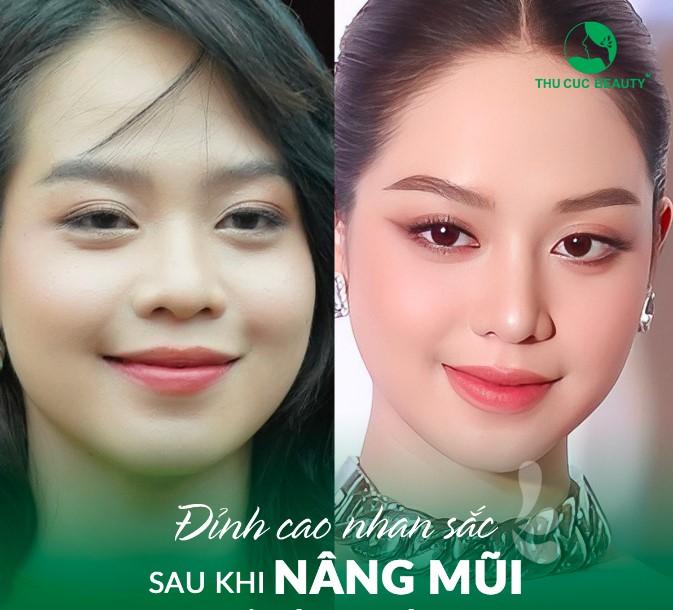 Bệnh viện thẩm mỹ Thu Cúc