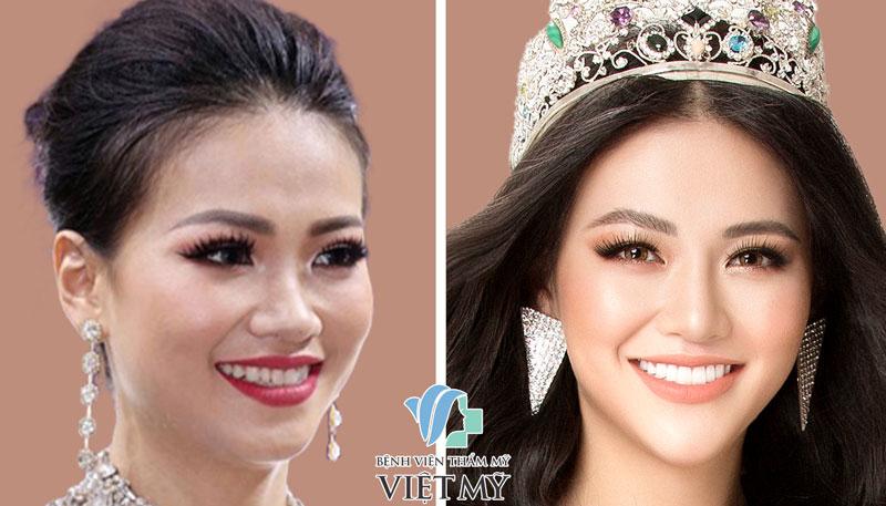 Bệnh viện thẩm mỹ Việt Mỹ
