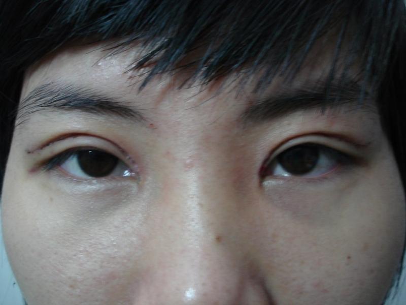BS Thẩm Mỹ Phúc