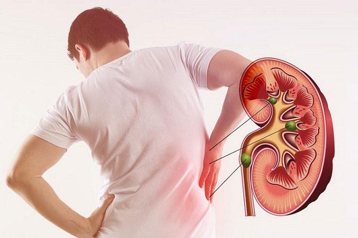 Cần điều chỉnh liều lượng dùng sản phẩm đối với bệnh nhân suy thận