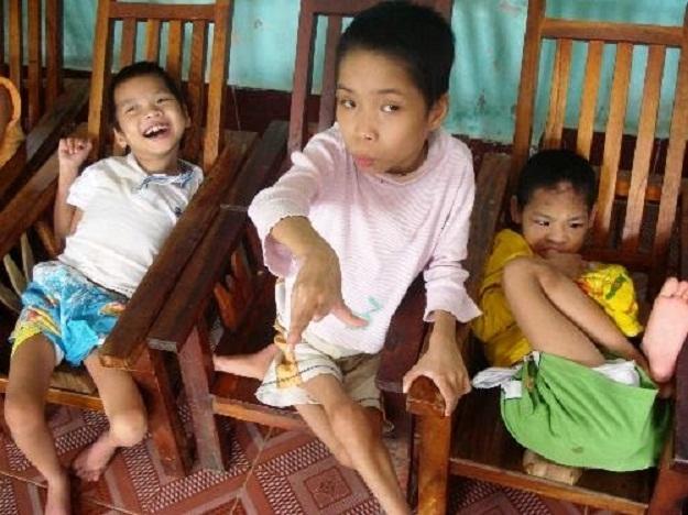 Trẻ bị chậm phát triển tâm thần