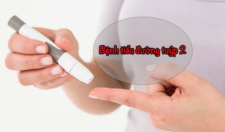 Chỉ định và chống chỉ định của Diamicron