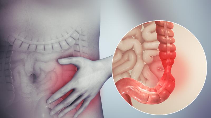 Chỉ định và chống chỉ định của Maldiv