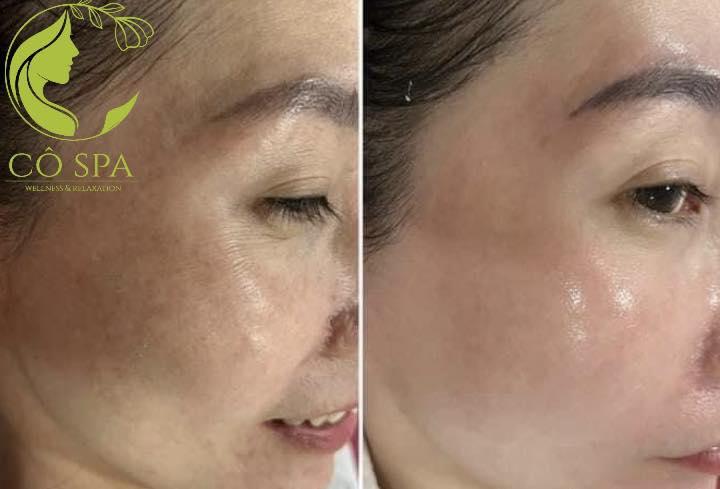 Cô Beauty Spa