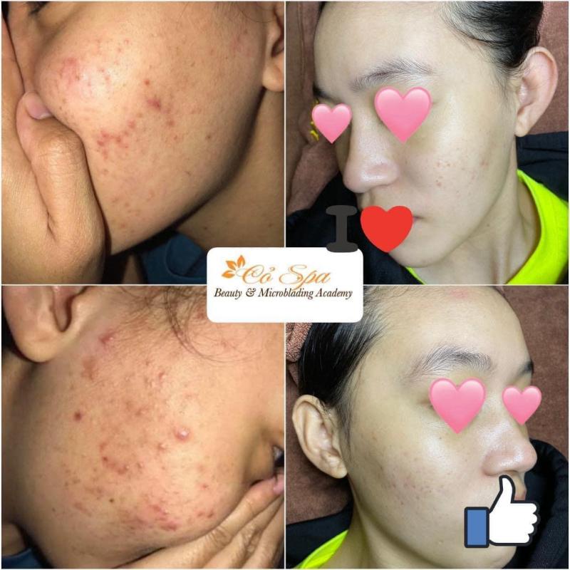 Cỏ Spa