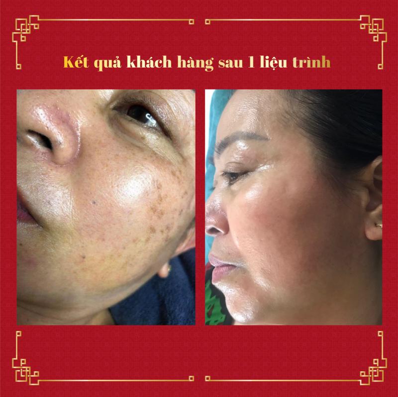 DORIS SPA - Spa trị liệu 4.0