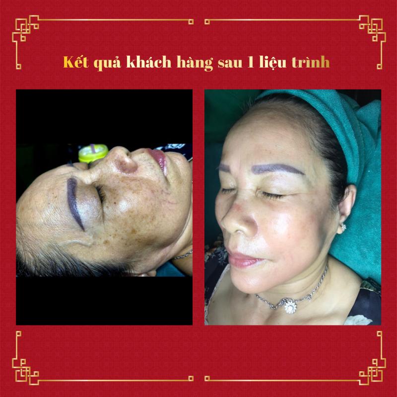 DORIS SPA - Spa trị liệu 4.0