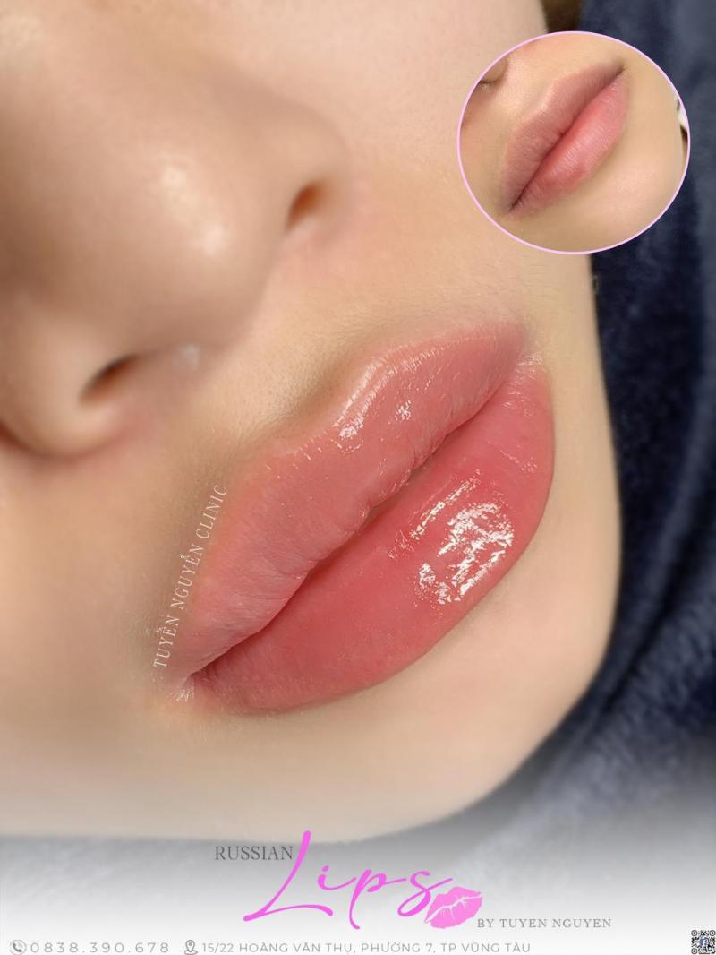 Tuyen Nguyen Beauty & Academy