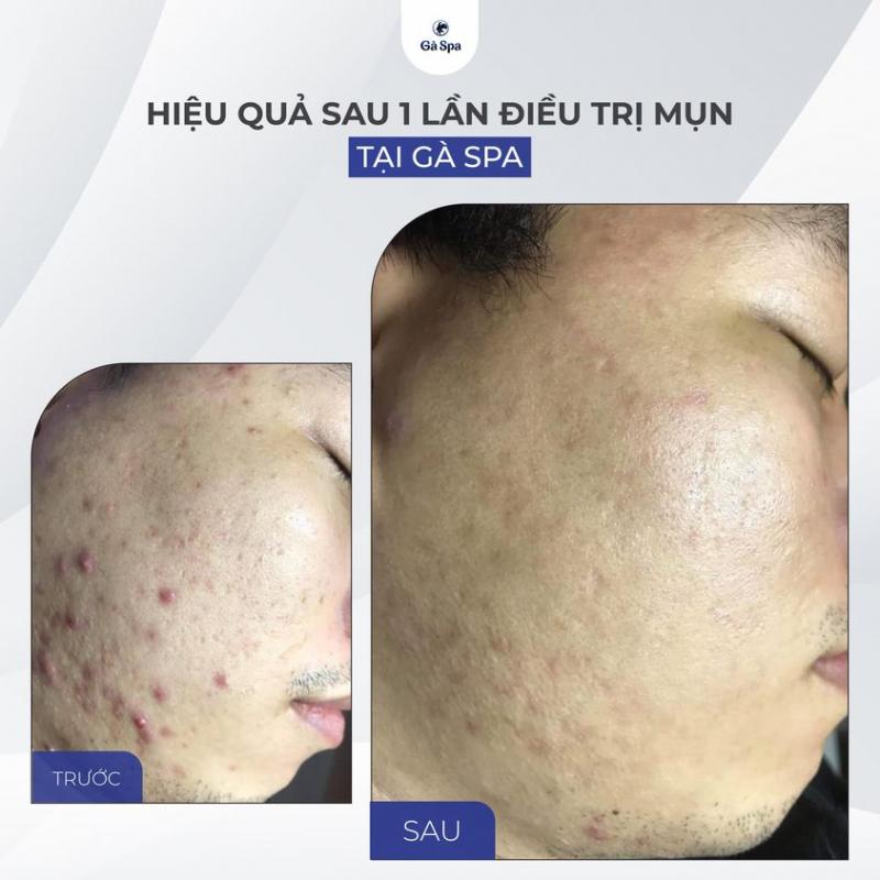 Gà Spa