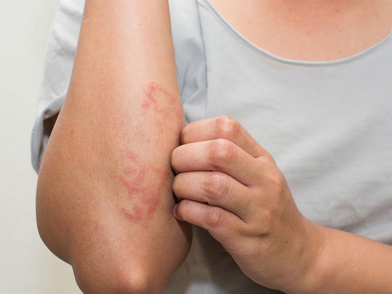 Gây ra các bệnh về da