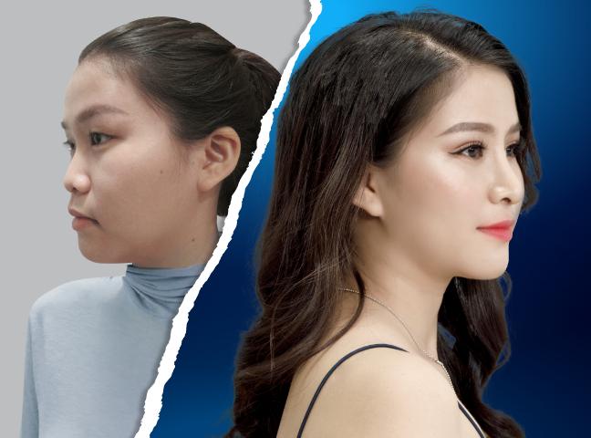 Kay Spa - Thẩm Mỹ Viện Công Nghệ Cao Tuy Hòa - Phú Yên
