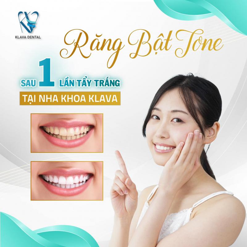 Klava Smart Dental