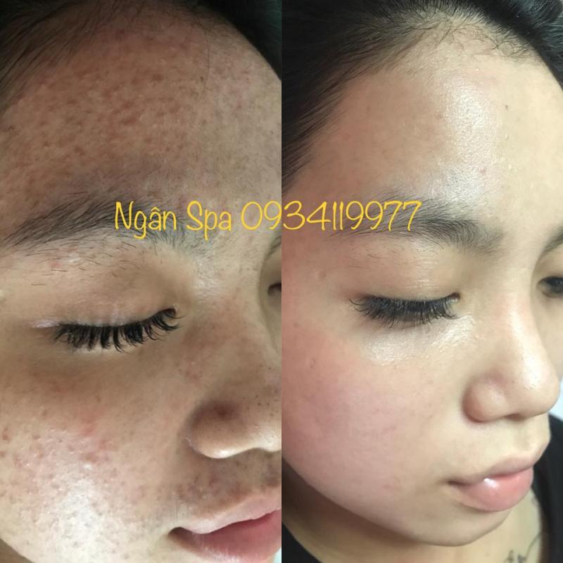 Ngân Spa Beauty Skin Care