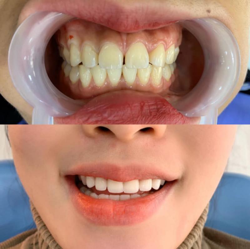 Nha Khoa Bạch Mai - Lạng Sơn