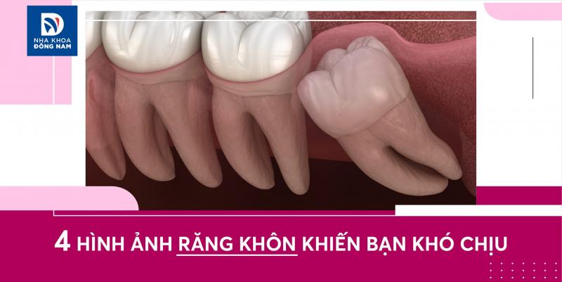 Nha Khoa Đông Nam