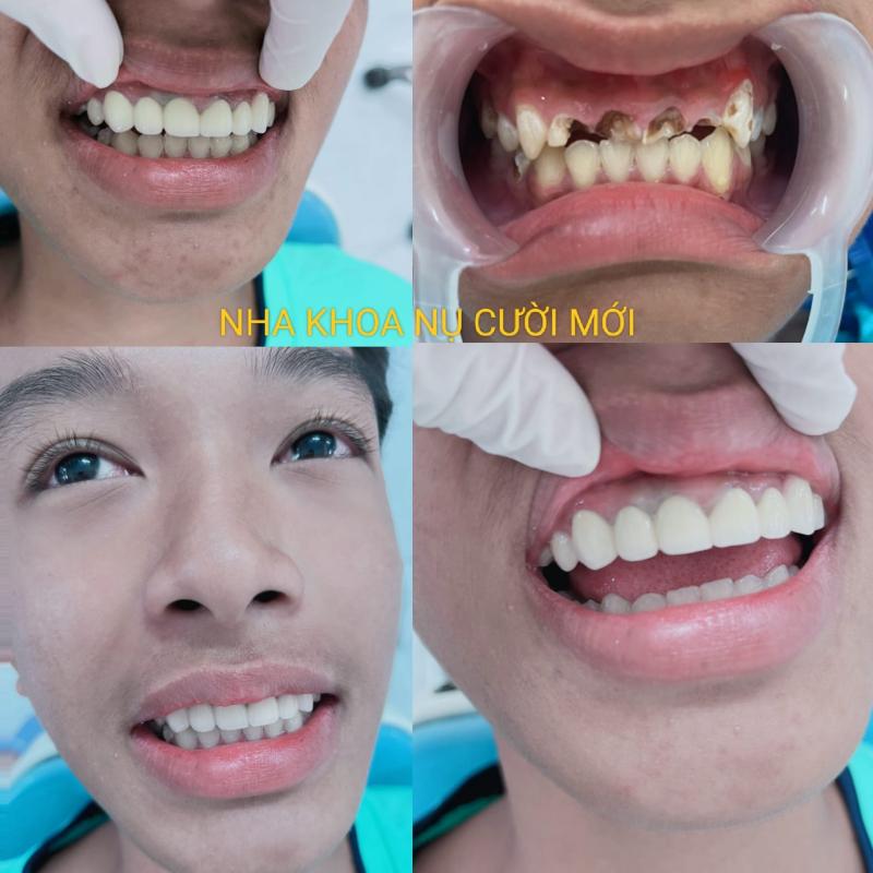 Nha Khoa Nụ Cười Mới