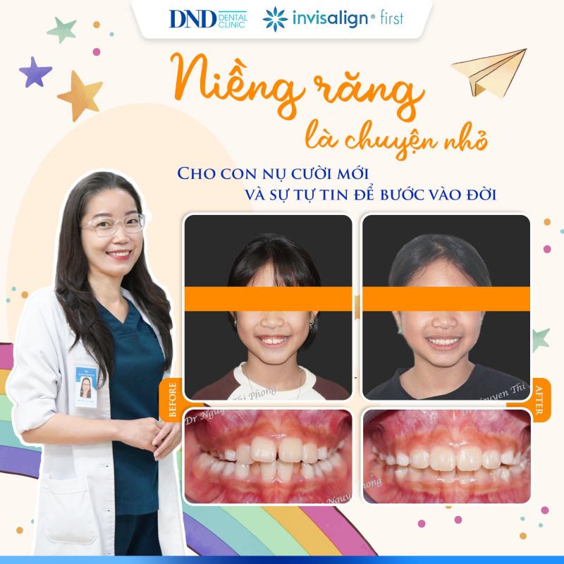 Nha khoa Quốc tế DND