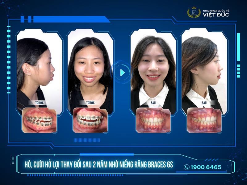 Nha Khoa Quốc tế Việt Đức