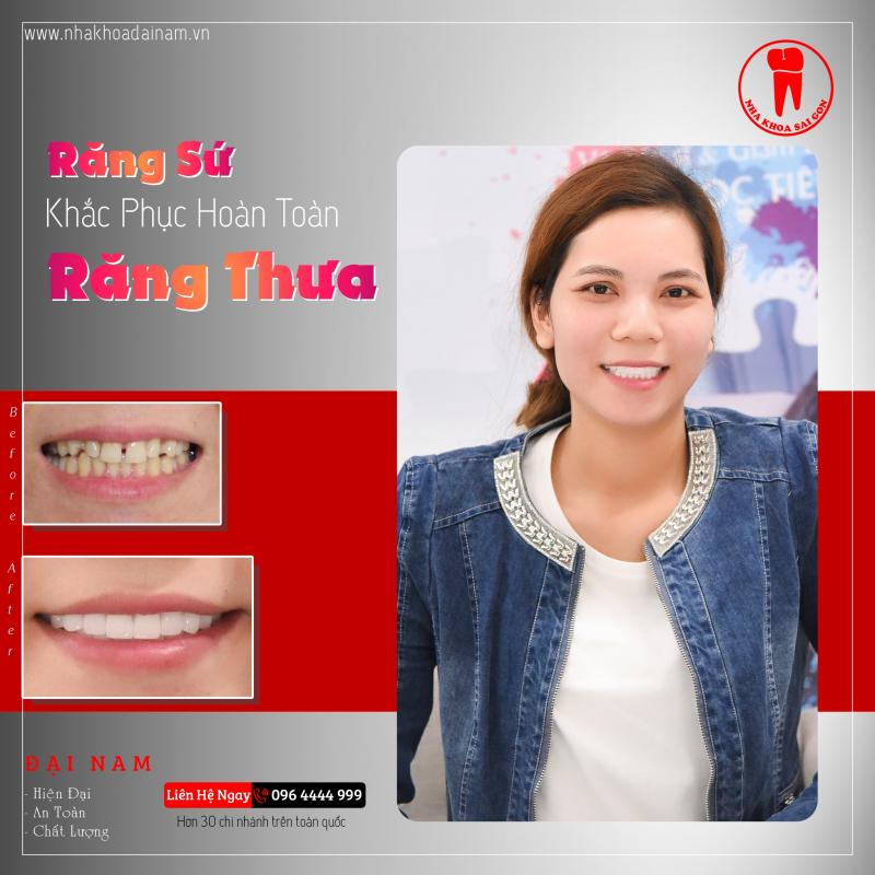 Nha Khoa Sài Gòn - Phan Rang